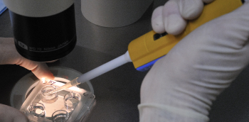 analyse des spermatozoïdes au microscope