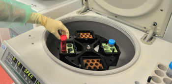 conservation des prélèvements de spermatozoïdes dans une machine